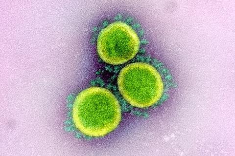 Novel_Coronavirus_SARS-CoV-2_(49640655213) (1)