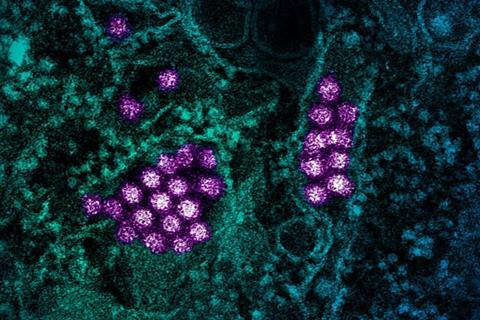 Dengue_Virus_Particles_(53232294339)