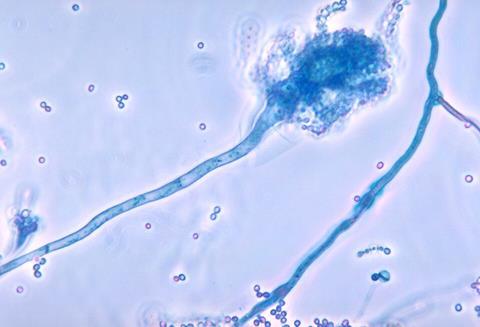 Aspergillus_fumigatus_01
