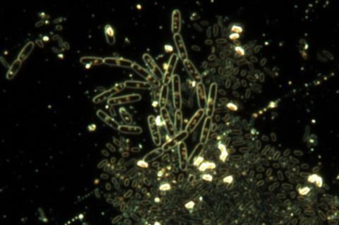 Spores_of_Bacillus_subtilis.tif