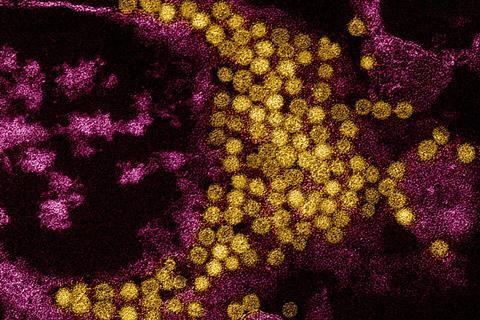 Enterovirus_D68_Virus_particles_colorized_transmission_electron_micrograph_-_211