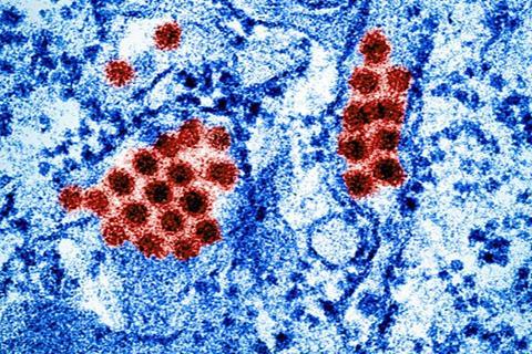 Dengue_Virus_Particles_(53232295844)