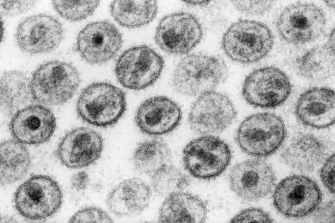HIV-1_Transmission_electron_micrograph_AIDS02bbb_lores