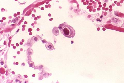 960px-Cytomegalovirus_01