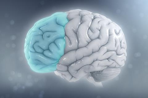 Attention_deficit_hyperactivity_disorder_-_Attention_deficit_hyperactivity_disorder_-_Reduced_brain_volume_on_the_left_side_from_ADHD