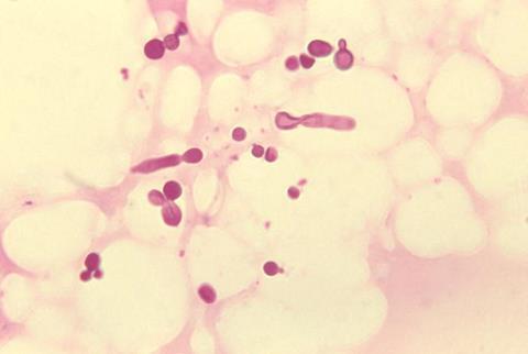 Malassezia_furfur_in_skin_scale_from_a_patient_with_tinea_versicolor_PHIL_3938_lores