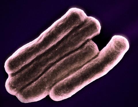 Mycobacterium_Tuberculosis_Bacteria,_the_Cause_of_TB_(52766722758)