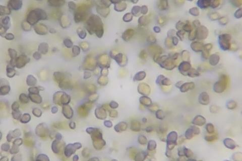 Microscope_view_of_Candida_albicans_20200228_134207_04