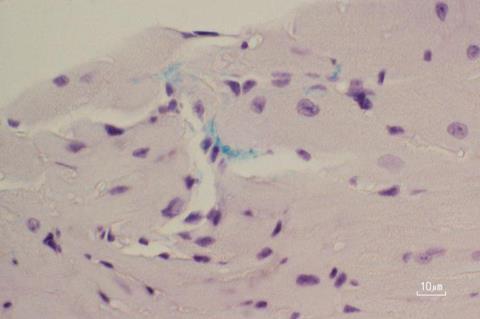 Low-Res_P gingivalis-mouse model-periodontitis and atrial fibrillation connection study