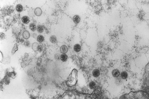 Epstein-Barr-Virus_CDC