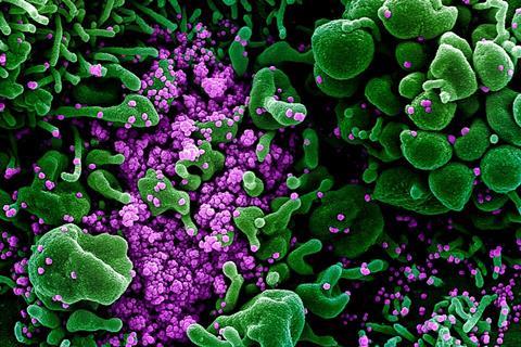 Novel_Coronavirus_SARS-CoV-2_(49666286236)