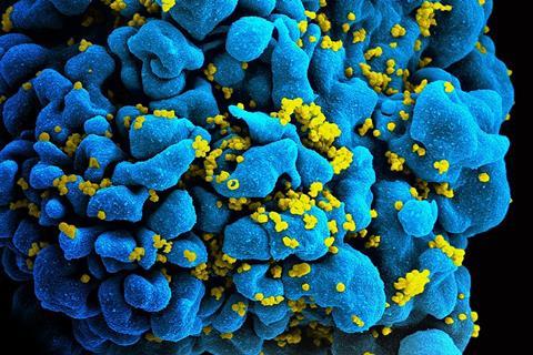 960px-HIV-infected_T_cell_(6813384933) (1)