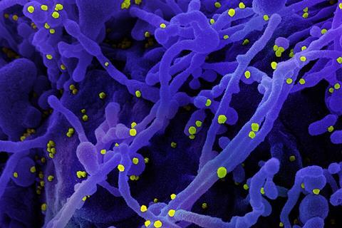 Novel_Coronavirus_SARS-Cov-2_(50010746961) (1)