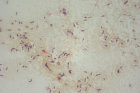 Clostridium_difficile_