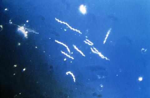 Borrelia_burgdorferi_(CDC-PHIL_-6631)_lores