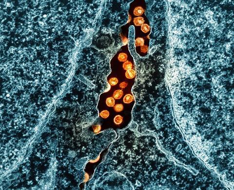 HIV_Virus_Particles_-_2 (2)