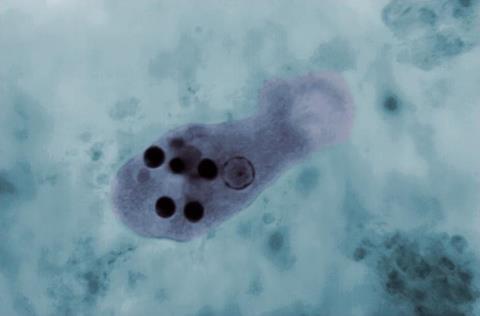 Micrograph_of_Entamoeba_histolytica