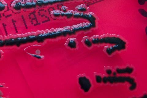 Salmonella_species_growing_on_XLD_agar_-_Showing_H2S_production_-_Detail