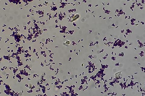 Gram_positive_rods_of_Diphtheroid