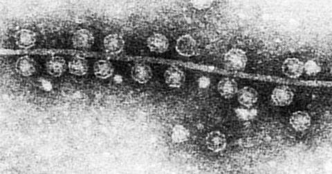 Bacteriophage_Qβ_attached_to_sex_pilus_of_E._coli