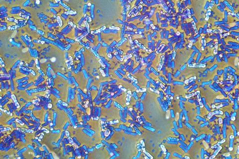 Eubacteria_(26_2_87)_Bacillus_subtilis;_spores_stained_green