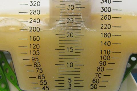 Pus in urine in severe UTI