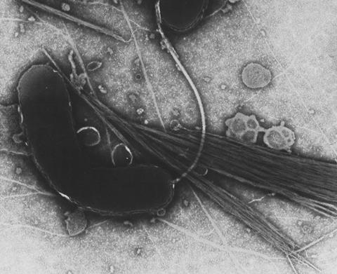 Transmission electron microscope image of <i>Vibrio cholerae</i>