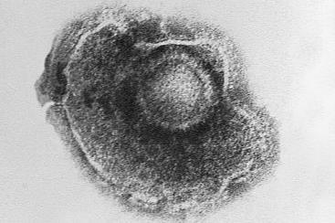 Varicella_(Chickenpox)_Virus_PHIL_1878_lores