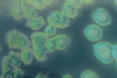 Pseudomonas_aeruginosa_on_cetrimide_agar