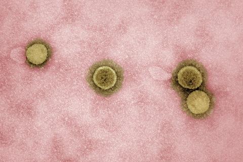 Novel_Coronavirus_SARS-CoV-2_-_53827311942 (1)