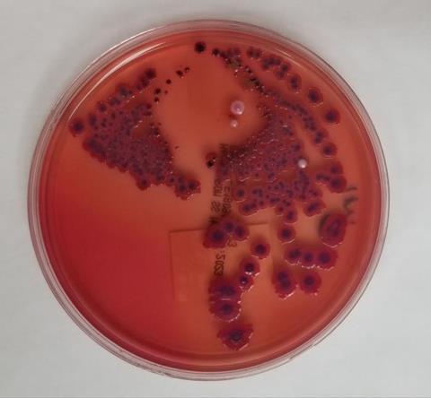 Low-Res_Fang Shigella 2 problematic (1) (1)