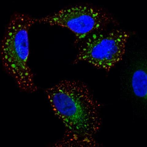 Low-Res_Bruce_influenza_cell