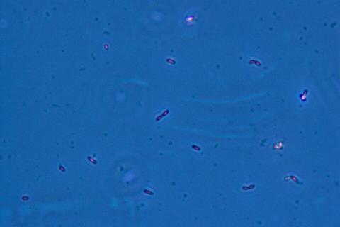 Geobacter_sulfurreducens.TIF