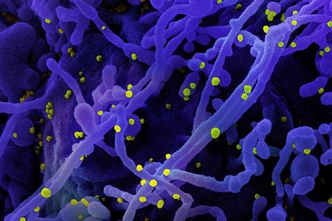 Novel_Coronavirus_SARS-Cov-2_(50010746961)