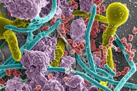 Low-Res_Polymicrobial infection