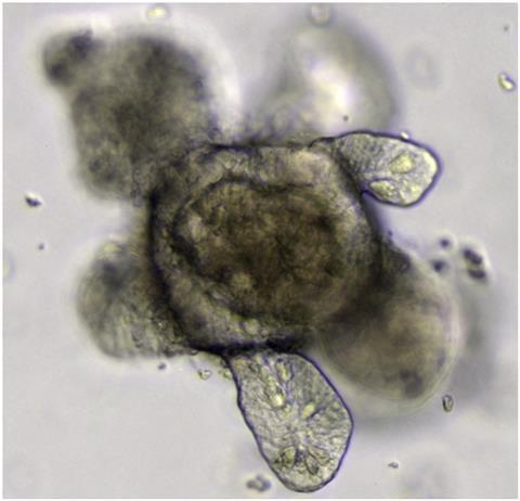 Intestinal_organoid