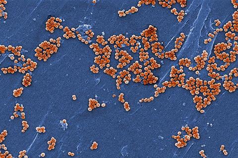 OSC_Microbio_04_04_ArtConn2_img