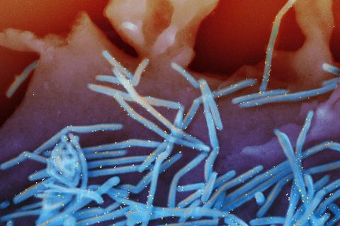 Human_Respiratory_Syncytial_Virus_(RSV)_-_52453988775