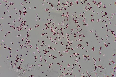 Gram_Negative_bacilli_of_Klebsiella_in_Gram_stained_smear_of_culture
