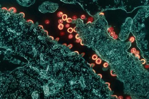 Low-Res_hiv-1-virus-particles-