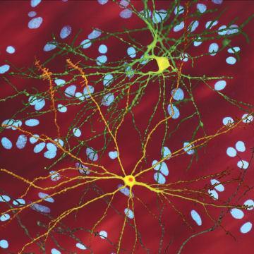 Neuron_with_mHtt_inclusion