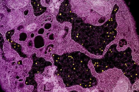 Colorized_transmission_electron_micrograph_of_yellow_fever_virus_particles_(yellow)_found_within_enlarged_cytoplasmic_vesicles_of_a_C6-36_cell_(pink)