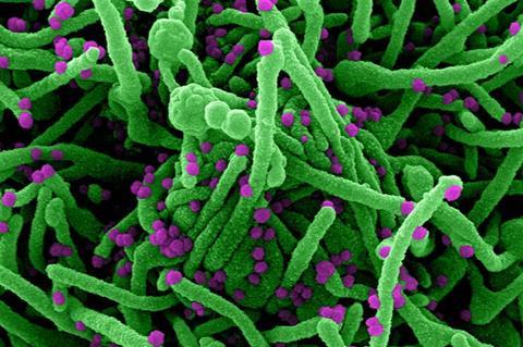 Novel_Coronavirus_SARS-Cov-2_(50010217143)