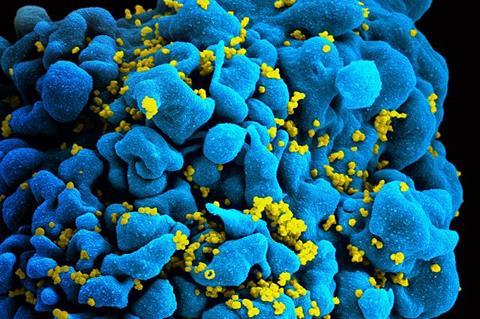 HIV-infected T-cell