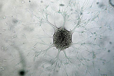 Immagine_di_cellula_di_Glioblastoma_multiforme_della_mia_linea_cellulare_patentata_presso_ECACC_ANGMCSS