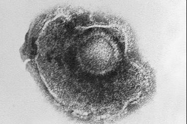 Varicella_(Chickenpox)_Virus_PHIL_1878_lores (1)