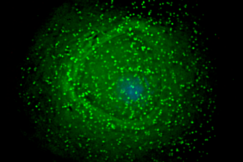 960px-HIV_on_macrophage