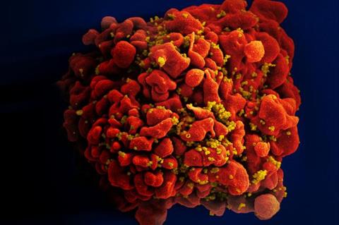 HIV-infected_H9_T_Cell_