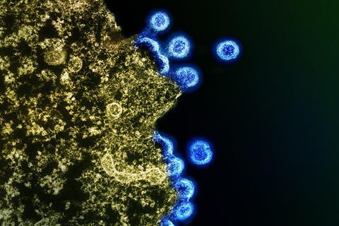 HIV_Virus_Particles_-_53567924670