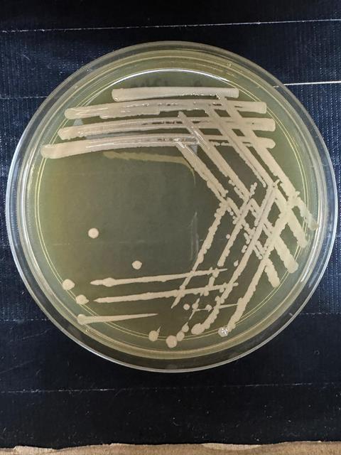 3. Gluconobacter japonicus T12B